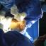 اجراء عمليات جراحية لتغير المفصل للمرة الاولى في محافظة دهوك